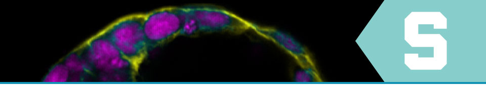 purple and lightgreen microscopic image on a black background with the MSU Spartan block S on the right edge