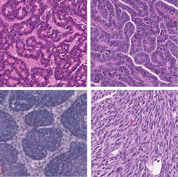 Heterogeneity and personalized therapy