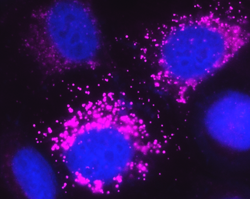Circular Purple Fluorescent scan of cells with pink dots around the border