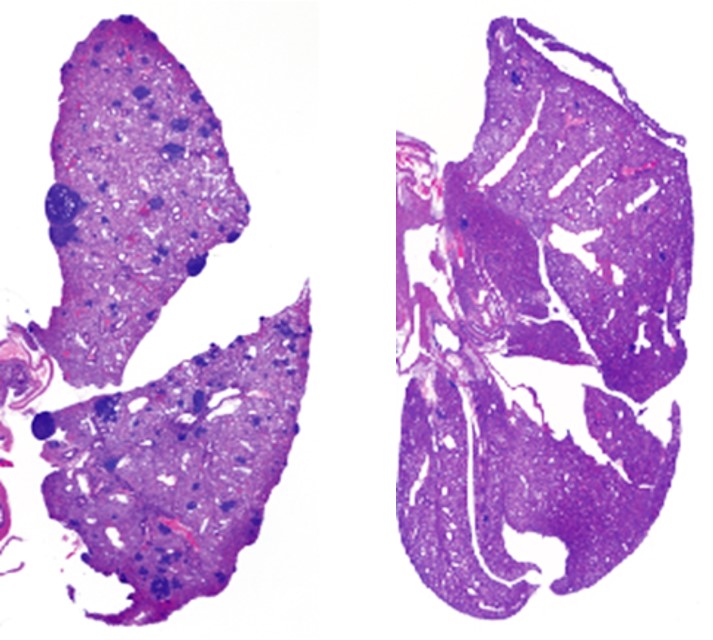 Purple scan of metasis